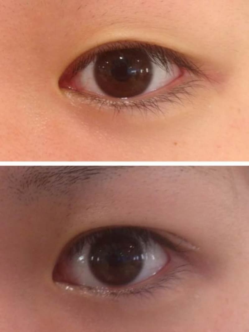 アイプチの代用で二重まぶたを作る！