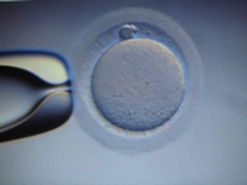 egg