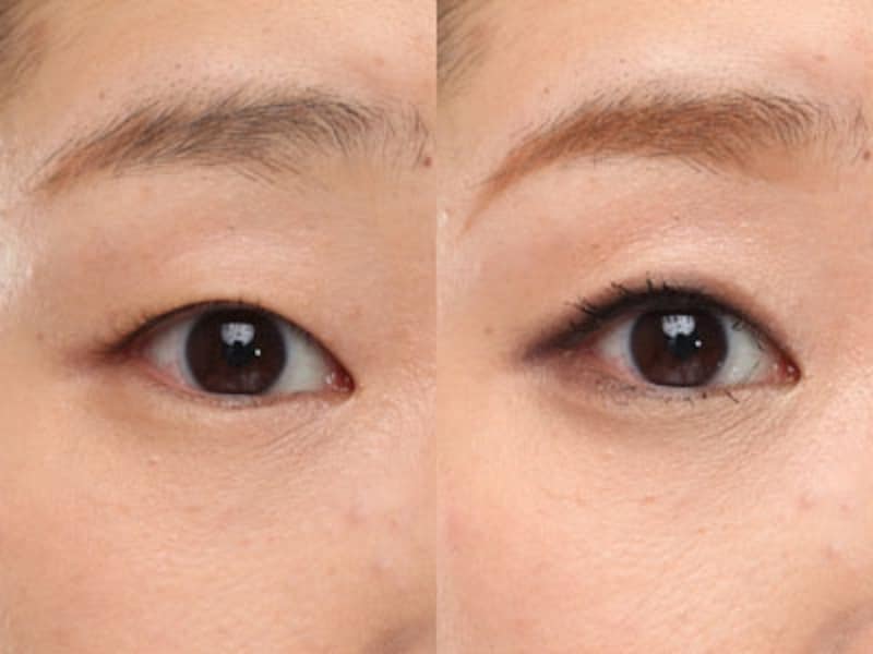 ビフォーアフター