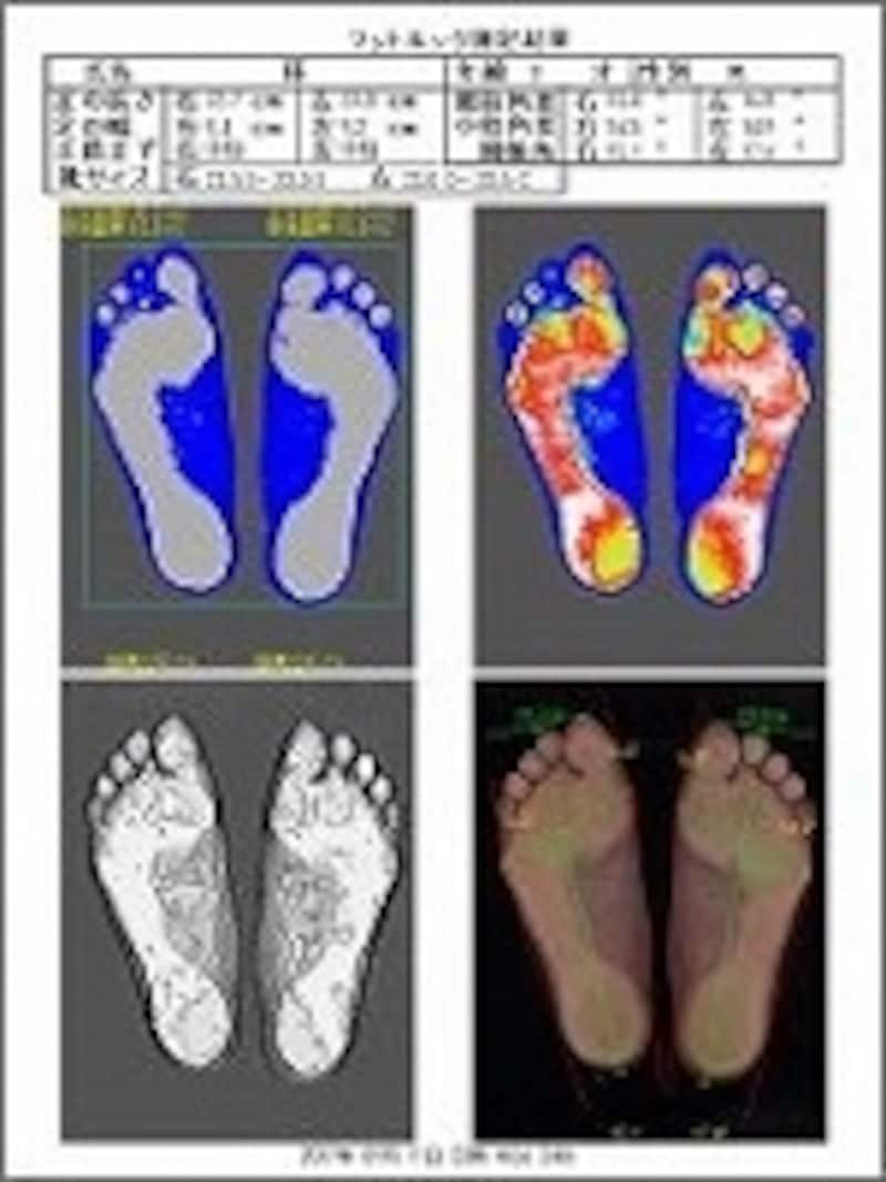 足 脚のトラブルは 足裏のアーチ の崩れが原因 フットケア All About