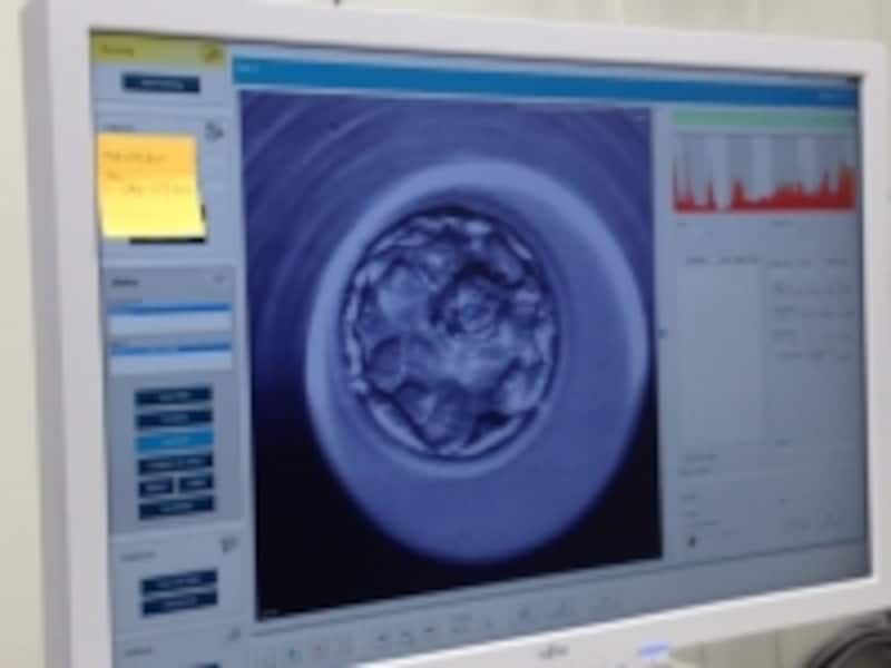 ファティリティ