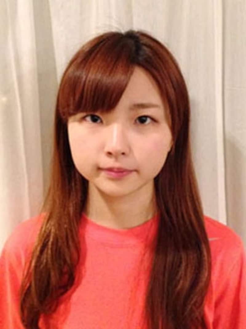 A子さん１回目アフター