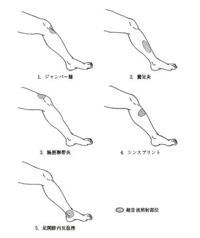 物理療法　問題