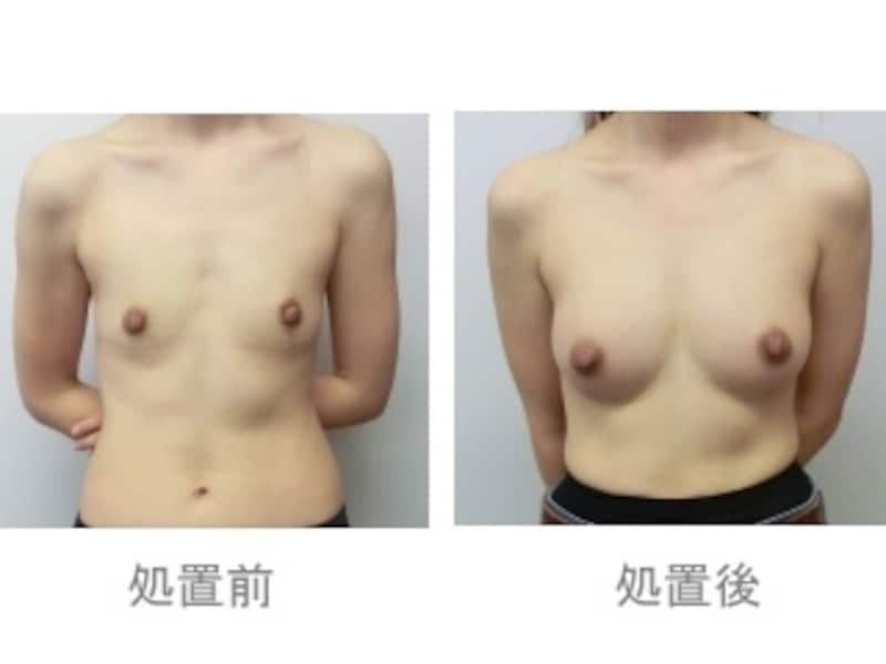 画像２