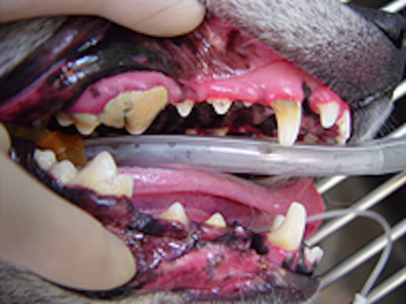 歯周病（中程度）