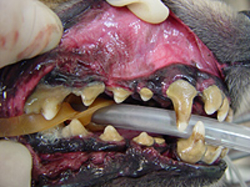 歯周病（重度）