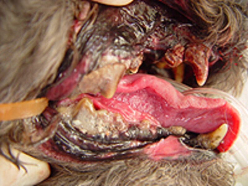 歯周病（強度）