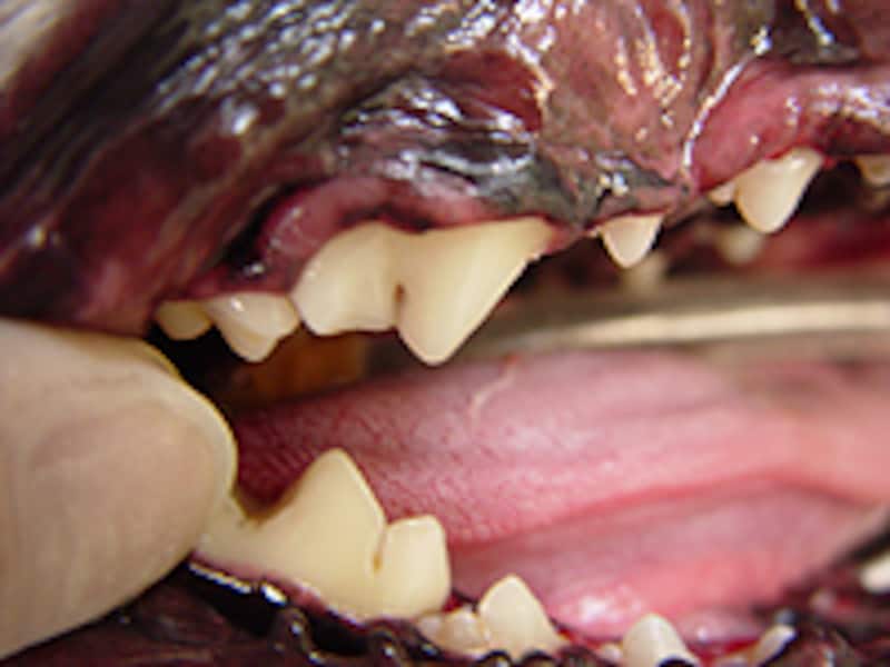 処置終了後の歯