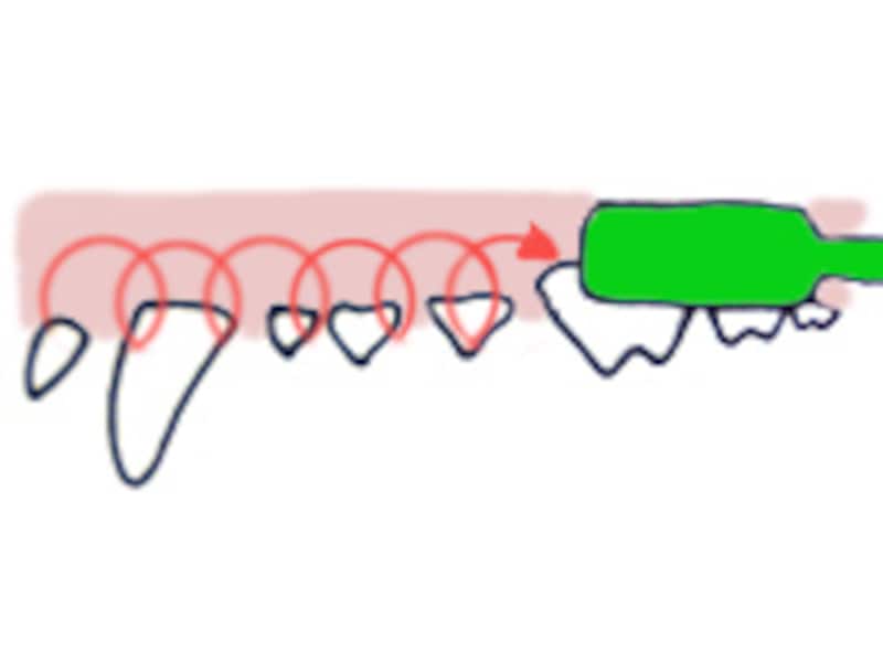 フォーンズ（ローリング）法