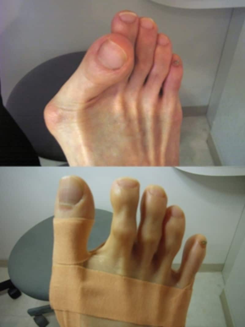 アーチバランストリートメント前後