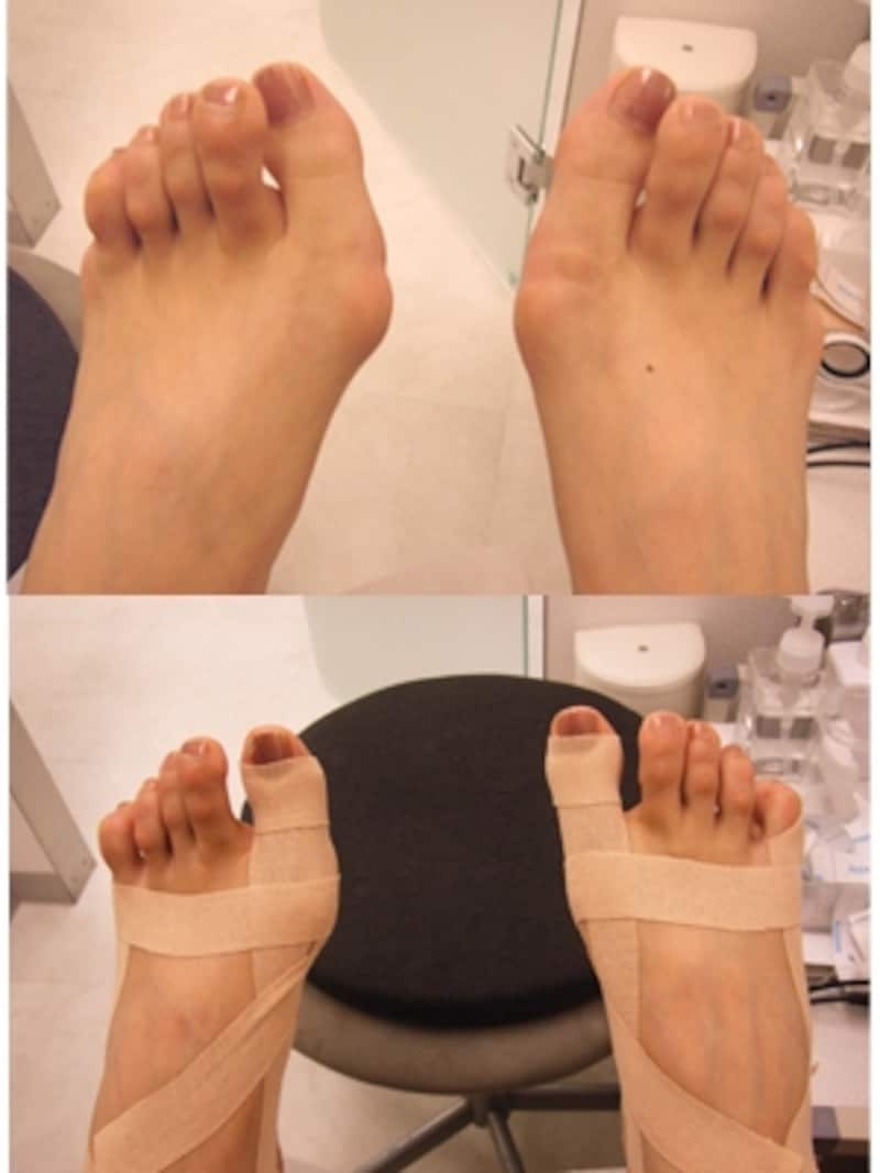 アーチバランストリートメント前後