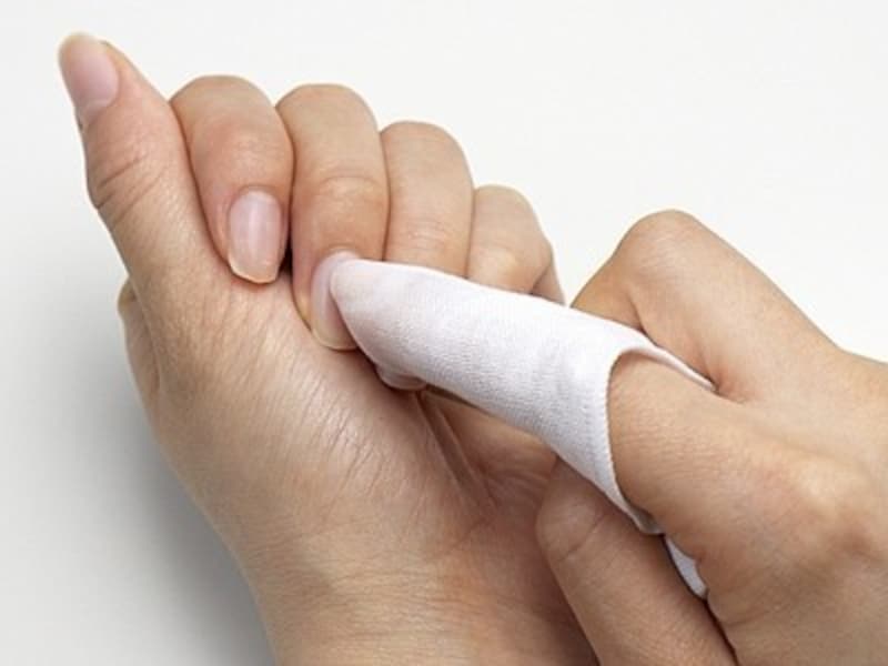 甘皮・ルーズスキンのお手入れ方法4:湿らせたガーゼできれいに取り除く