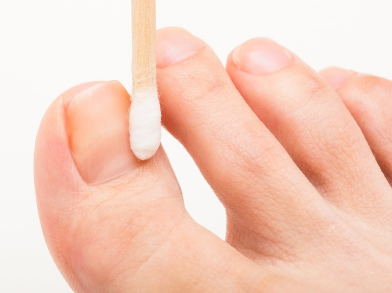 強くこするとダメージに