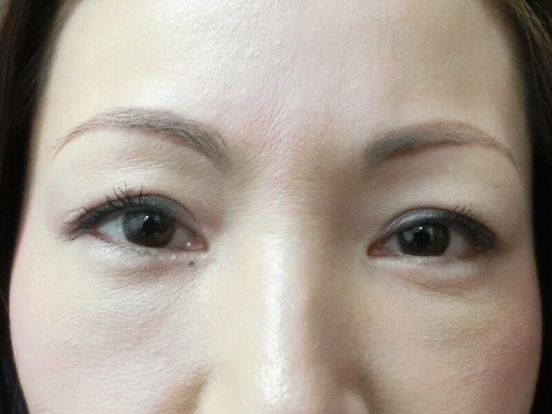 目のクマをとったところ