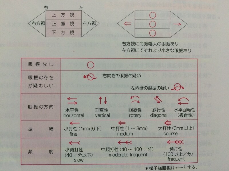 眼振