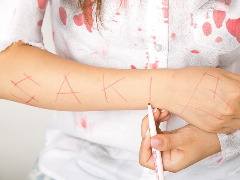 1undefined切り傷のデザインを考え、線の両端が鋭角になるよう描く