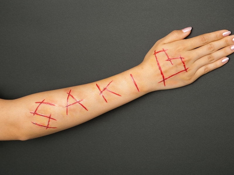 かわいい傷メイク