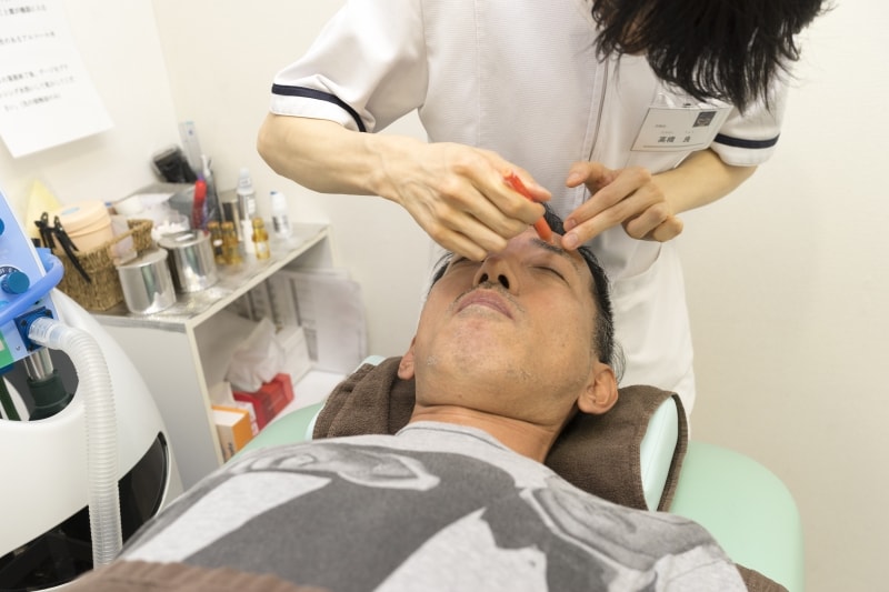 眉毛の脱毛部分をマーキング。