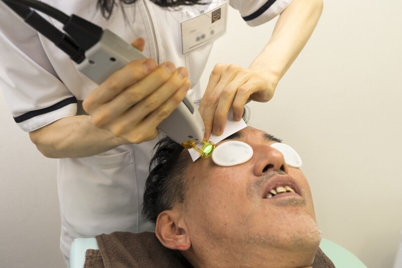眉毛のレーザー照射。