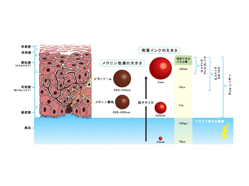 ピコレーザーと従来のレーザーの違い。
