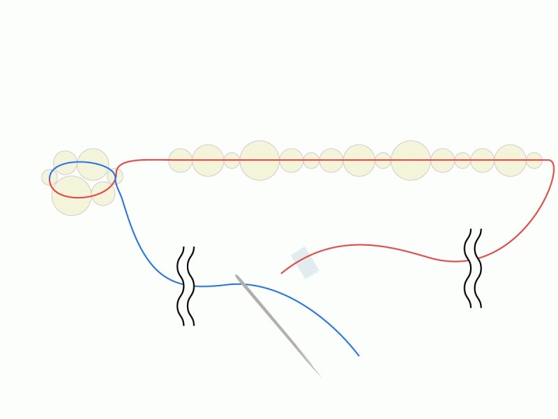赤と青の糸を均等な力で引くのがコツ。