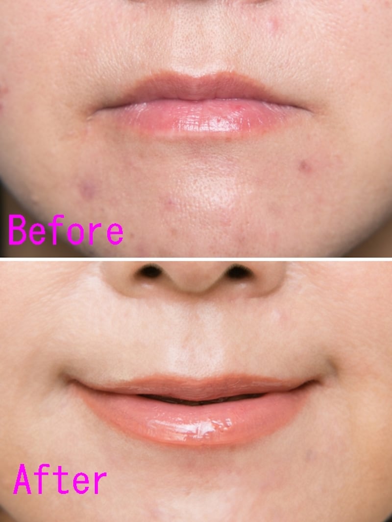 (上)NGほぼすっぴんリップ(下)OK口角UPリップ