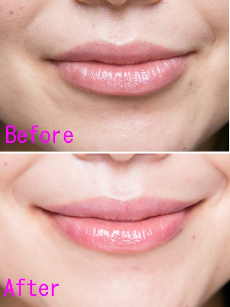 （上）NGほぼノーメイクリップ（下）OK艶っぽいリップ