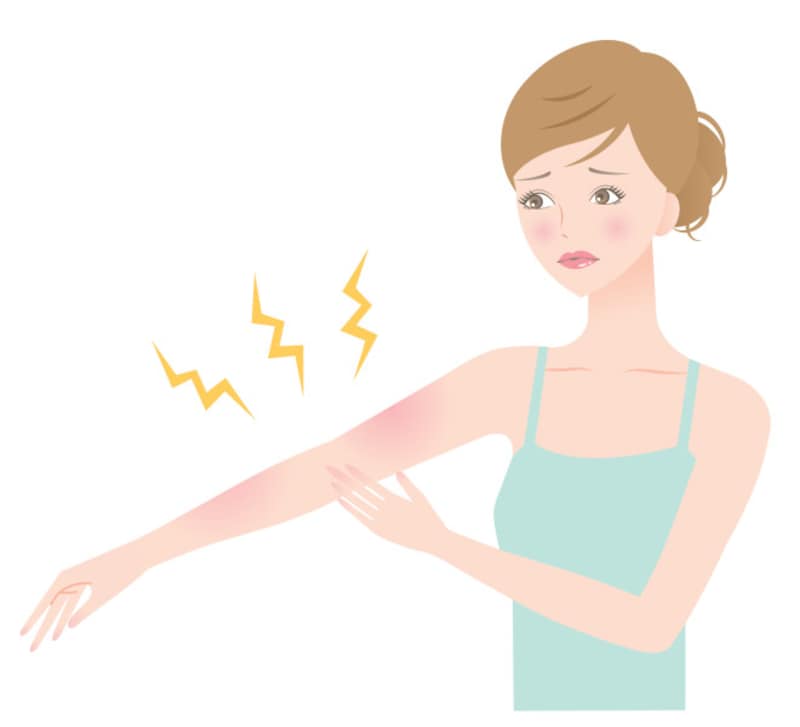 日焼け後の痛みや赤みは、肌が炎症を起こした状態