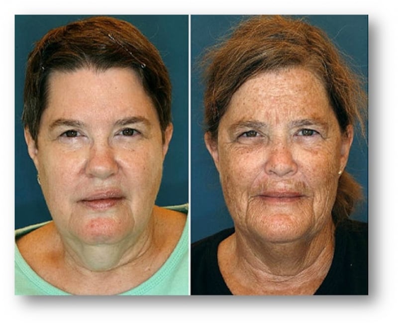 スモーカズフェイス