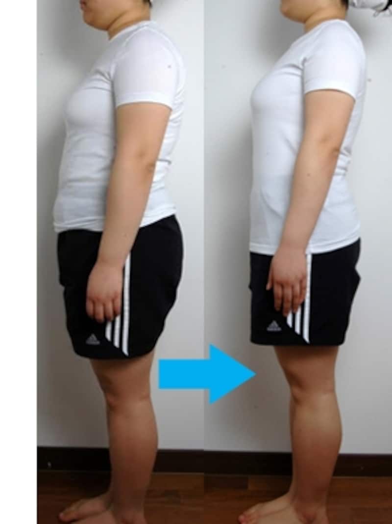 実際に韓方ダイエットを実践した女性のビフォーアフター。