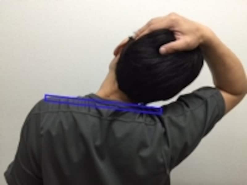 肩が上がるだけではなく、上半身そのものが傾いてしまう人もいます