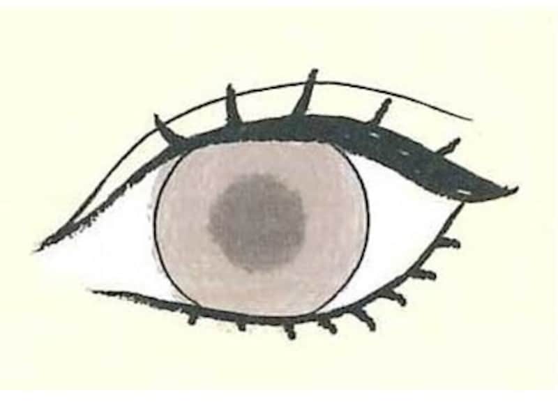 二重幅を整えて、ぱっちりデカ目に