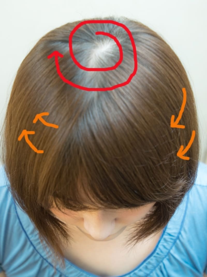 つむじから時計回りに生えているケースがほとんど