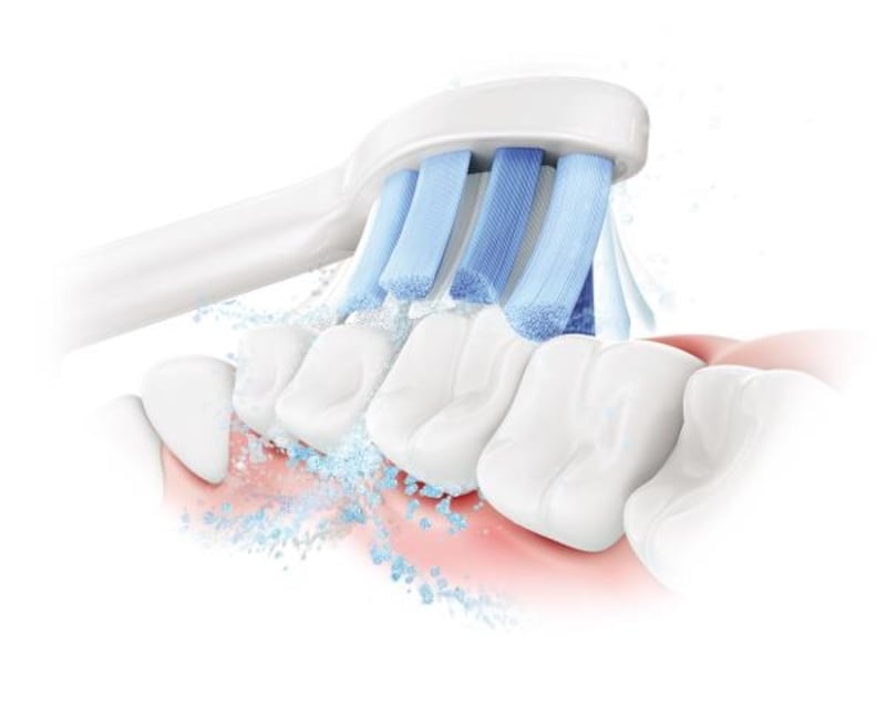 ガムプラスモードで歯ぐきケア