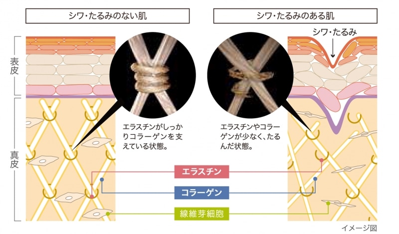 エラスチンが不足すると肌は弾力を失ってしまいます