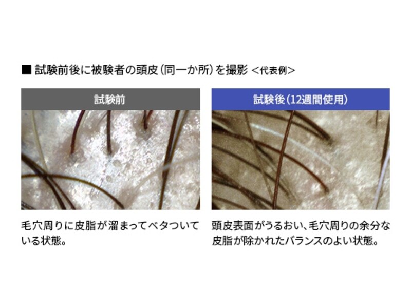 12週間で頭皮環境に改善が見られたという(シャープホームページより)