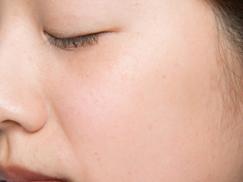 ビフォア。血色が悪く見えてしまいがちなすっぴん頬。
