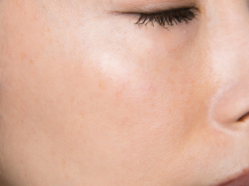 ビフォア。色ムラや毛穴が気になるすっぴん肌。