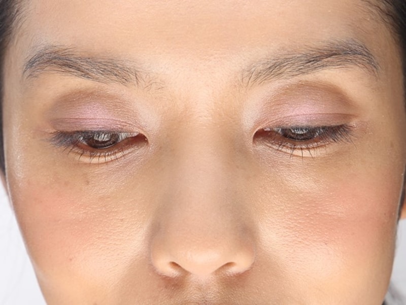 影になってしまっているbefore