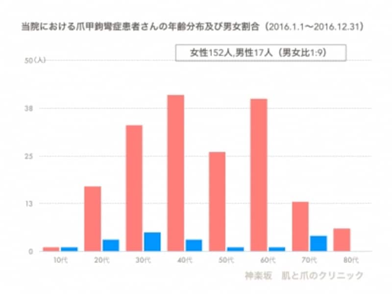 爪甲鉤彎症の9割が女性