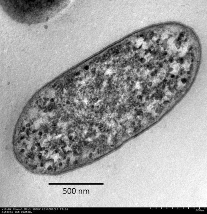 メチロバクテリウム