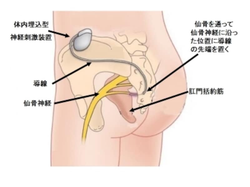 神経刺激