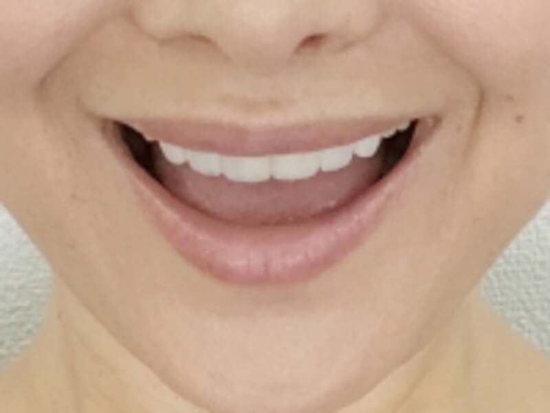 kuchi5