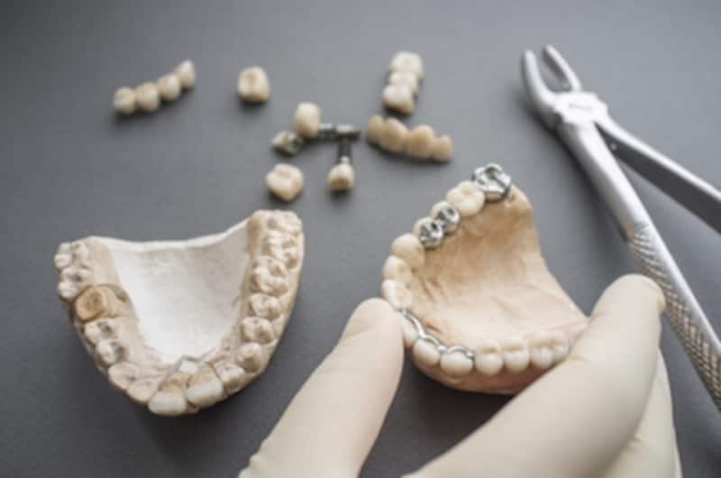 歯の再治療はどうして起こる