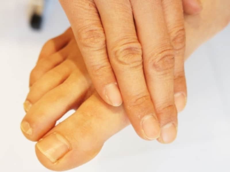 足 の 親指 の 裏 痛い 足の親指の付け根が痛い、これは痛風か外反母趾か、見分け方と対処方法