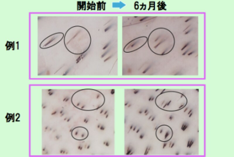 ストレスによる薄毛対策には 押す 頭皮ケア アンチエイジング All About ストレスによる薄毛対策には 押す 頭皮ケア アンチエイジング All About