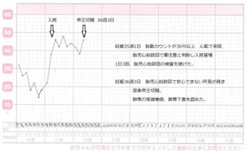 胎動カウントのすすめ 意義 方法 グラフ 妊娠中期 All About 胎動カウントのすすめ 意義 方法 グラフ 妊娠中期 All About