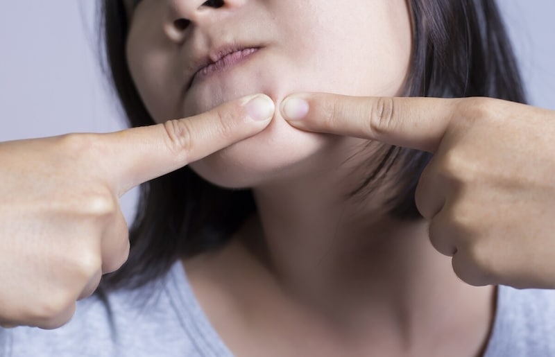 顎のニキビが痛い・しこりができた・繰り返す…原因と治療法