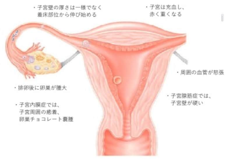 妊娠初期　腹痛