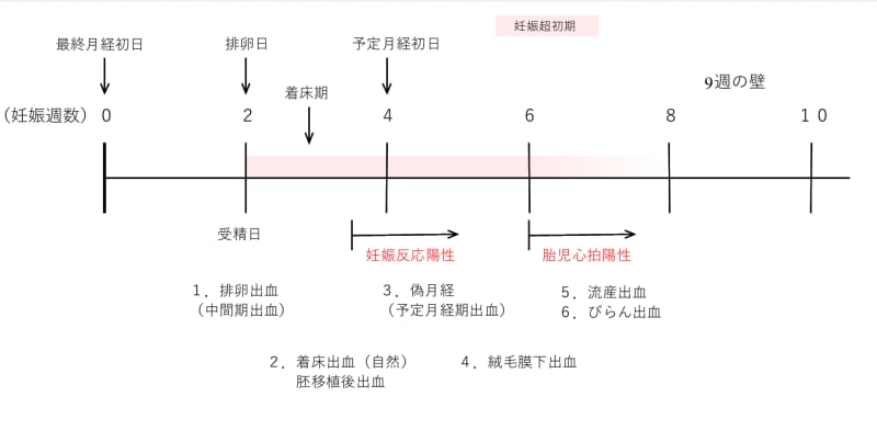 妊娠超初期　出血